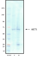 AKT1 (RAC-alpha) Western Blot Data